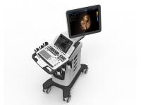 V60 Color Doppler Diagnostic Ultrasound System