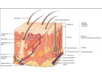 Causes and treatment of ichthyosis