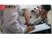 Why have I tried so many products but still with ichthyosis?