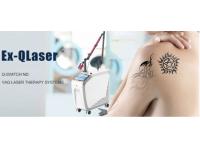 Requests to inquire purchasing ND YAG laser machine