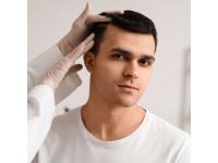 Hair Loss Treatment London: Trusted Pharmacy Solutions for Lasting Results