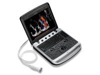 Ultrasound for Knee Pain: A Non-Invasive Solution for Relief