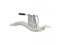 Monoaxial reduction pedicle screw Type-IV